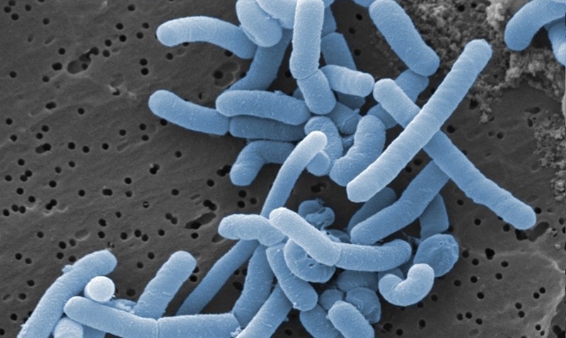 Lactobacillus paracasei Postbiotics Lactobacillus paracasei Postbiotics